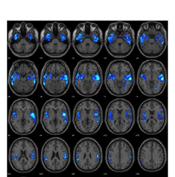 “Young killers’ brains are different, study shows” ABQ JOURNAL – Kent A ...